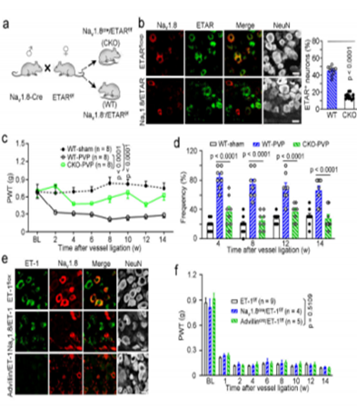 登录国际期刊 | 南通大学团队使用明美倒置荧光显微镜MIX60-FL揭示血管痛新机制