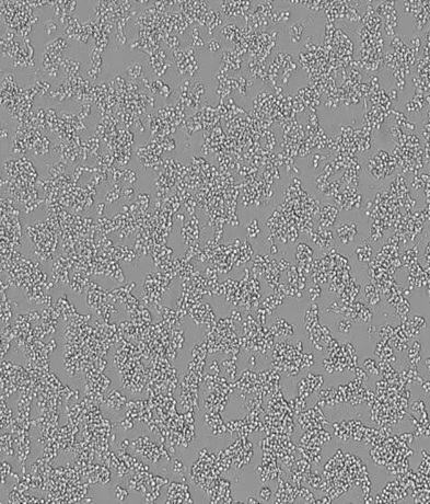 小鼠单核巨噬细胞RAW264.7的汇合度实时分析实验
